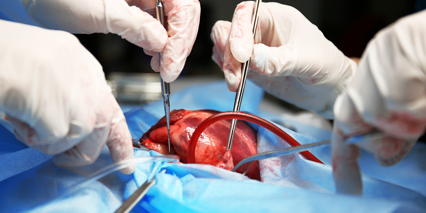 Alpharetta startup’s technology could revolutionize cardiac surgeries